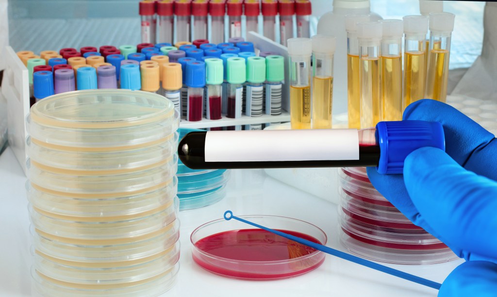Diversi tipi di campioni di laboratorio raggruppati su un tavolo