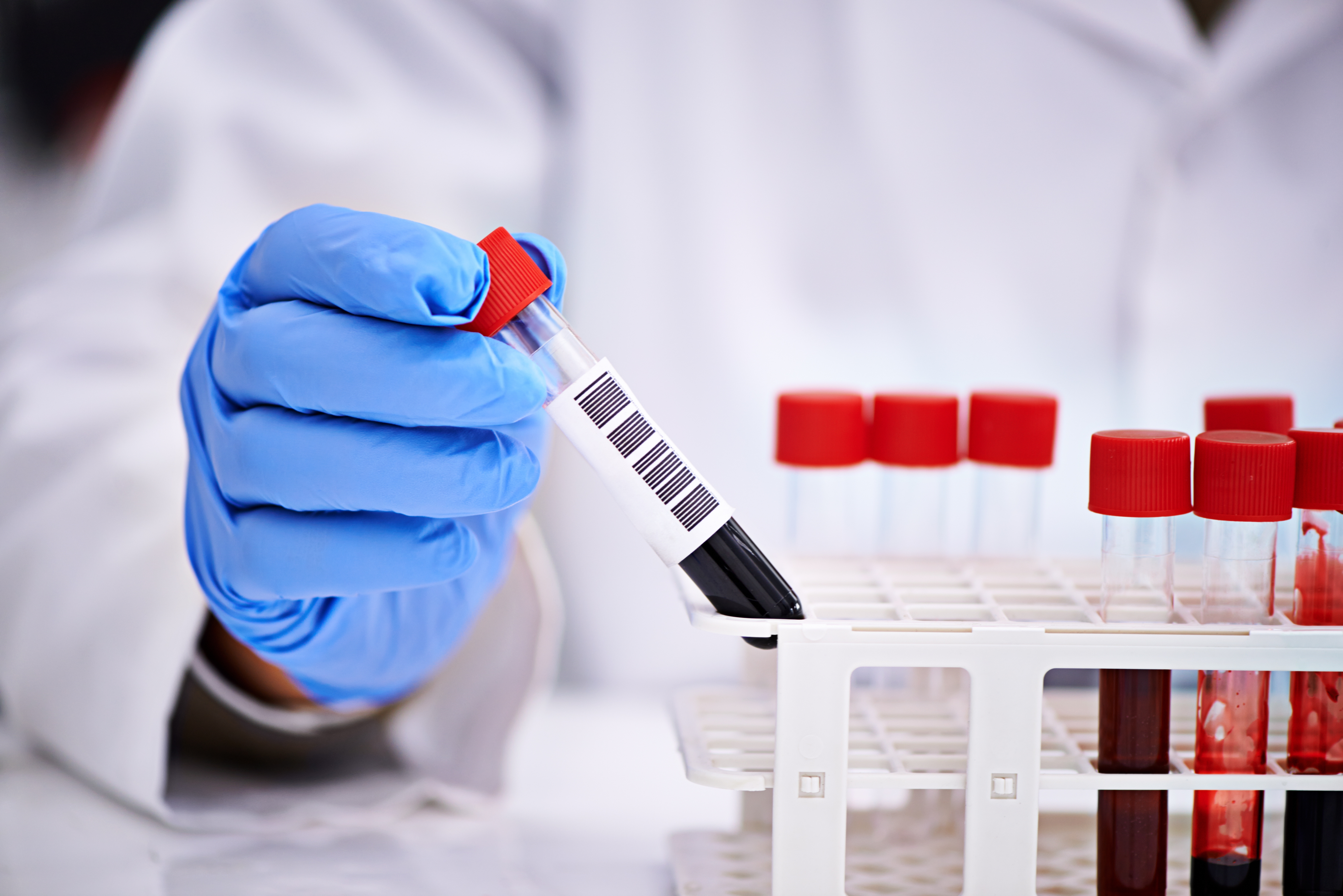 Blood,Test,,Hand,And,Scientist,In,Laboratory,For,Research,,Studying