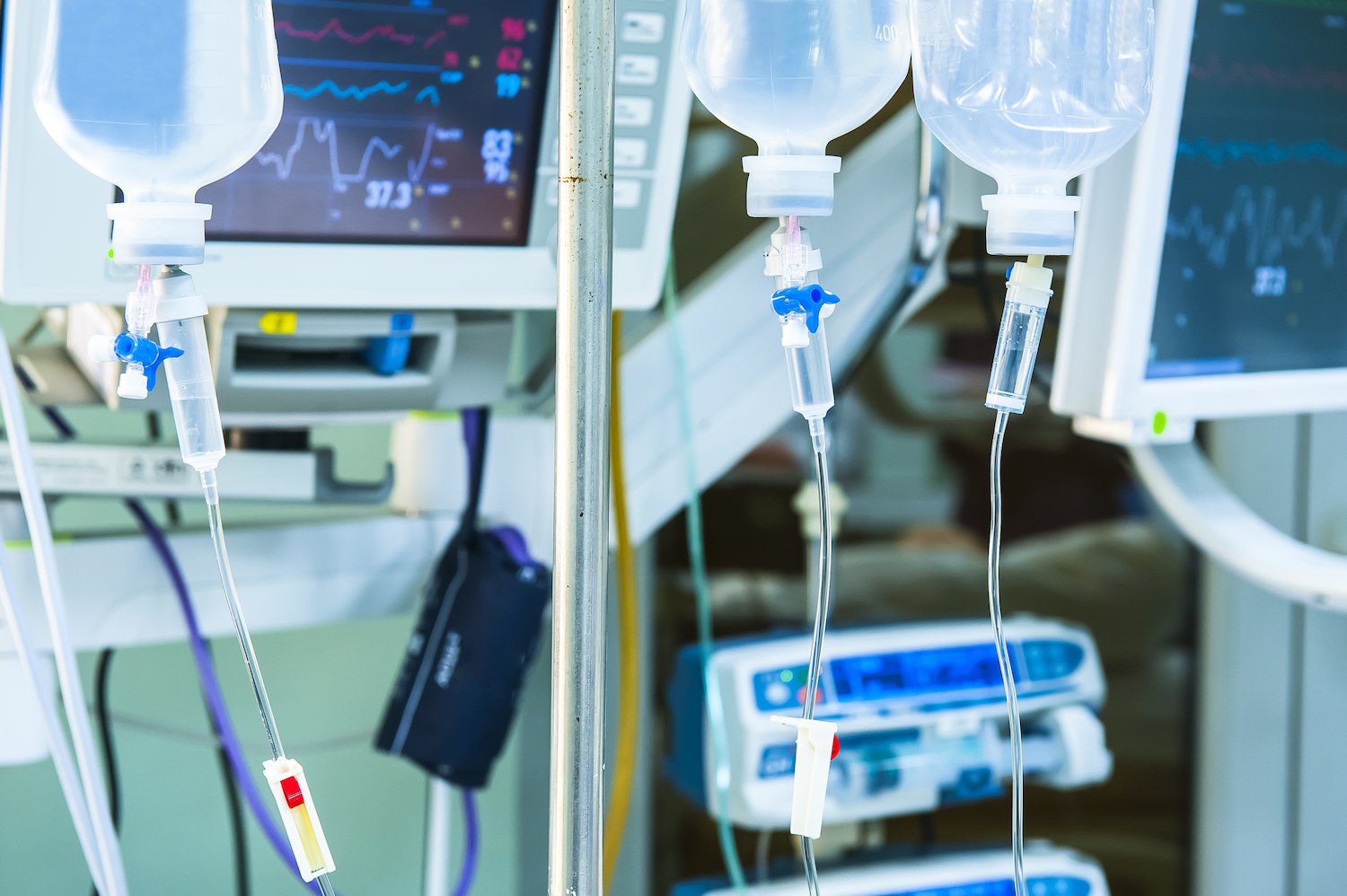 Fluid Management Systems